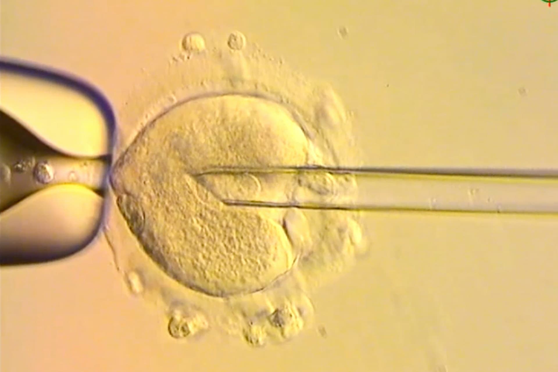 Via X Over the past few years, researchers have coaxed ordinary stem cells into clusters that, left to their own devices, organize themselves and behave for several days much like an embryo just settling into the womb.